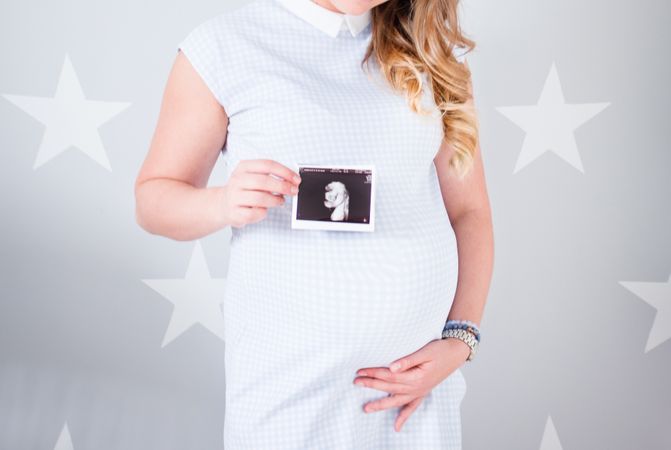 Pregnant Woman Wearing White Cap-sleeved Dress Holding Ultrasound Result Photo Photo