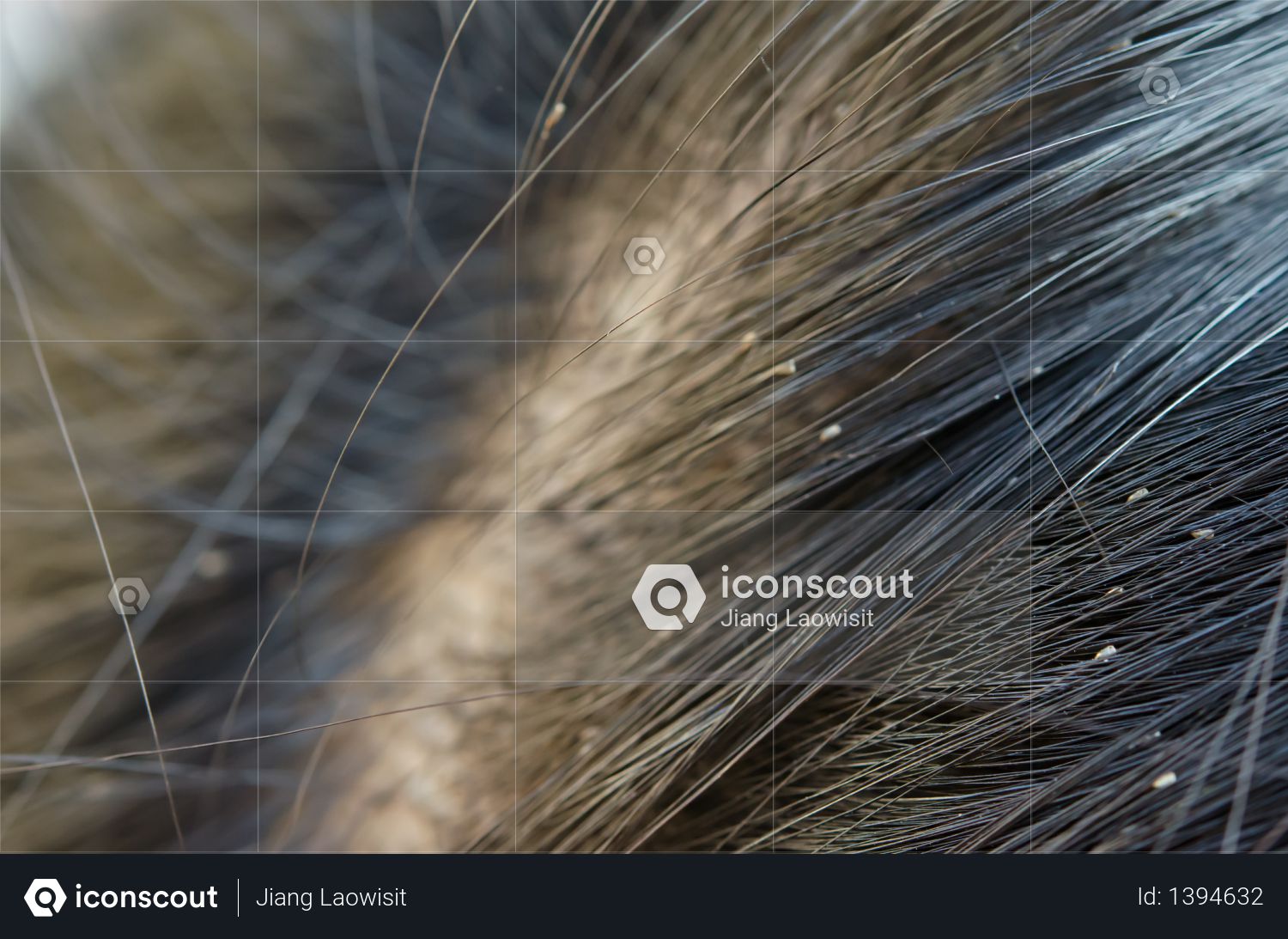 Premium Louse Egg On The Hair Causes Itchy Head Photo Download